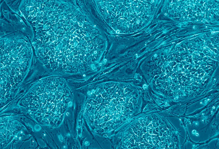Comparing HUCT Cells to Bone Marrow Stem Cells: Pros, Cons, and Applications