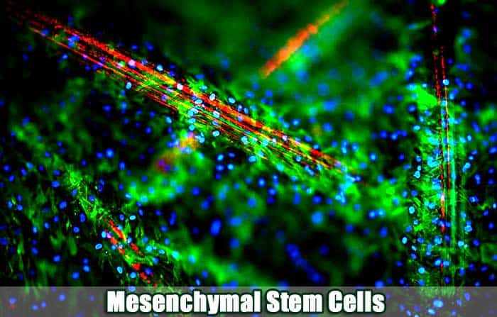 Mesenchymal Stem Cells vs. Traditional Surgery: Which Wins for Tissue Repair?