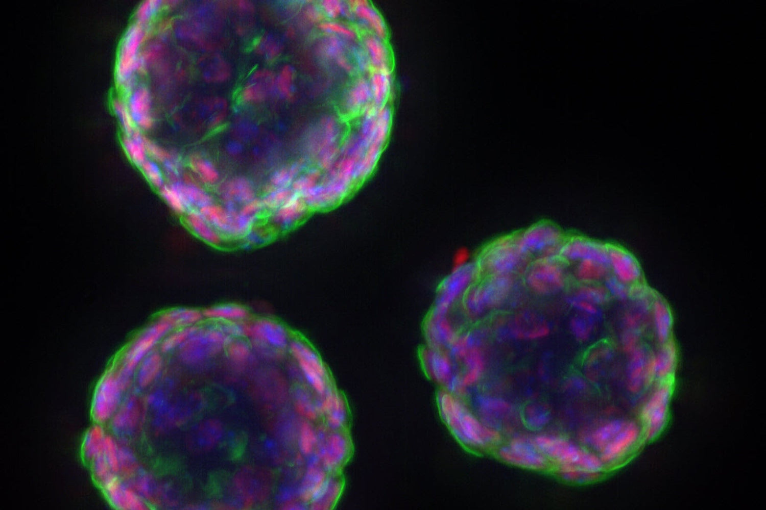 Organoids on the Rise: Mini-Organs in Labs Paving the Way for Drug Testing and Transplants