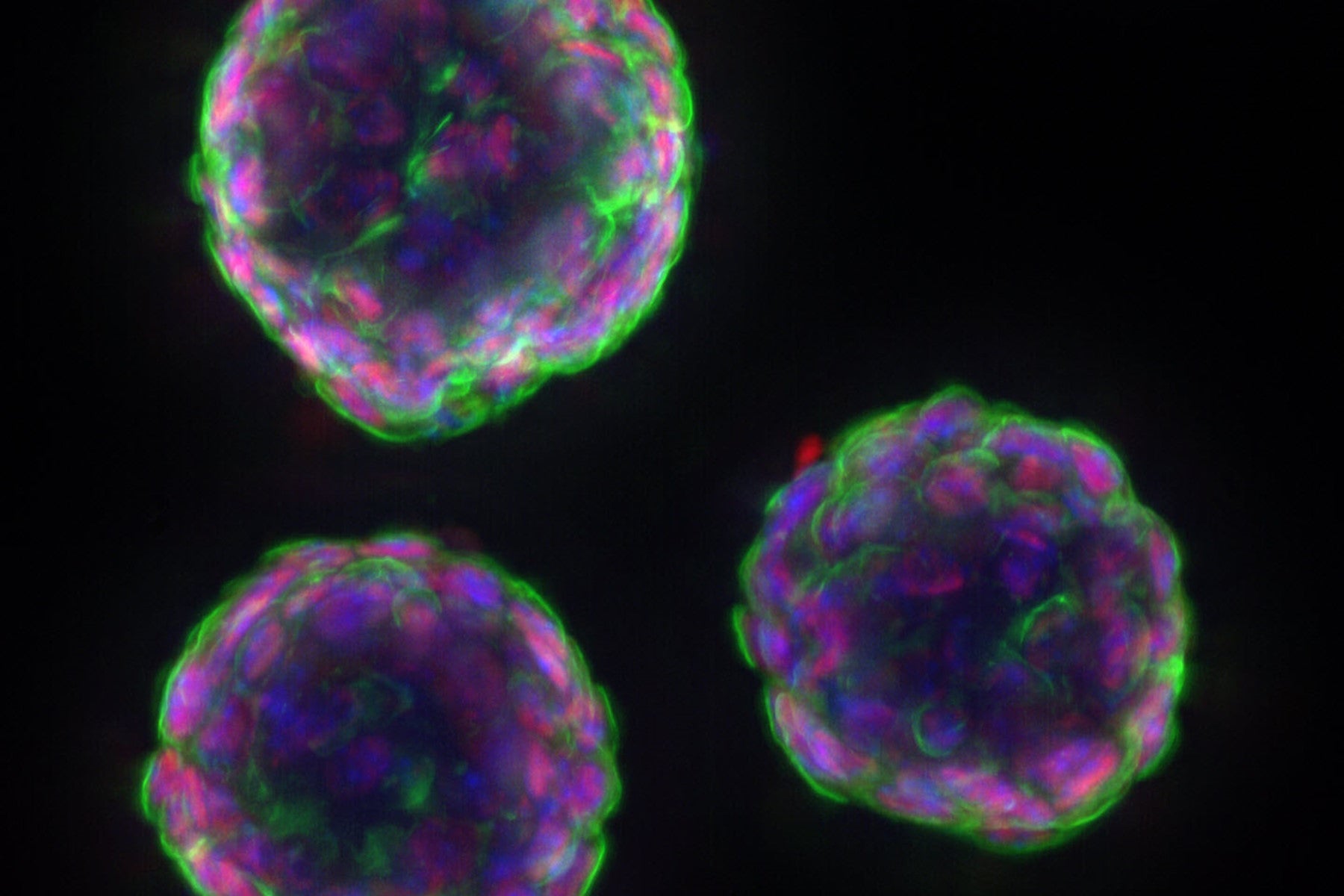 Organoids on the Rise: Mini-Organs in Labs Paving the Way for Drug Testing and Transplants