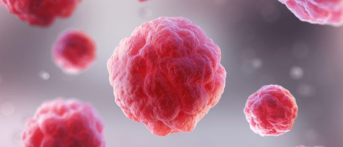 A New Dawn for Multiple Sclerosis: Exploring Placenta Stem Cell Therapy