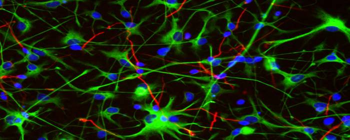 Exosomes & Secretomes: Cell-Free Strategies Inspired by Stem Cell Power