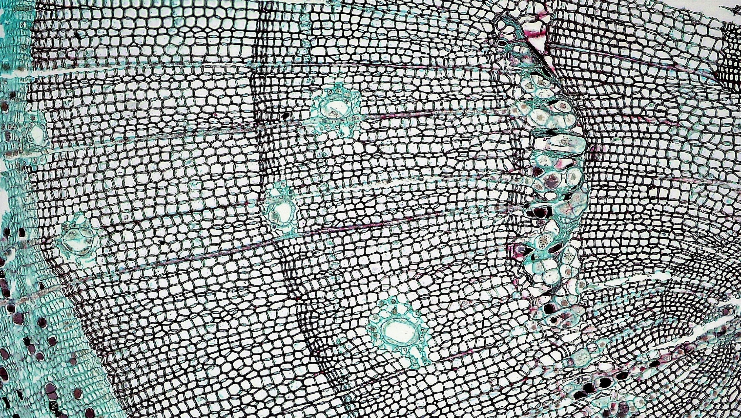 Exploring Immunomodulation Strategies in Advanced Stem Cell Applications