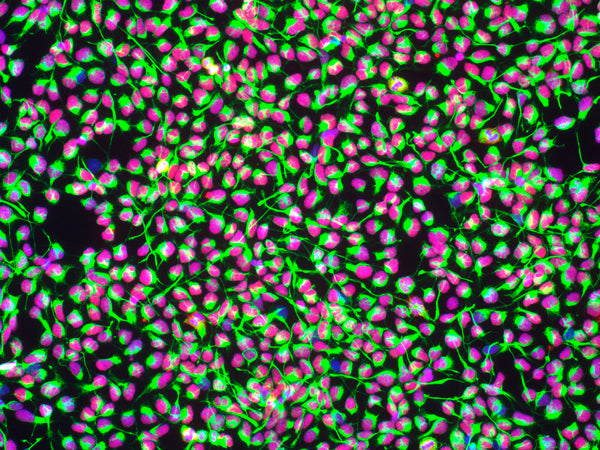 Unveiling the Hidden Battles: The Immune System's Role in Stem Cell Journeys